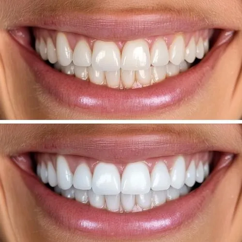 before and after comparison of a smile after cosmetic dentistry