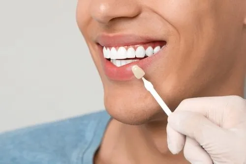 dentist holding a tooth shade guide next to a patient's smile during a cosmetic consultation