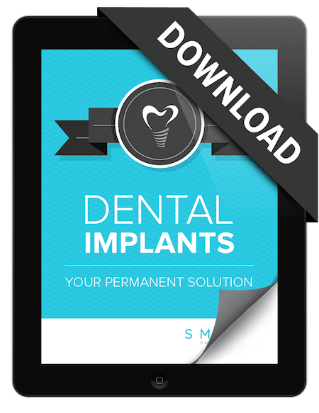 Dental Implants eBook cover