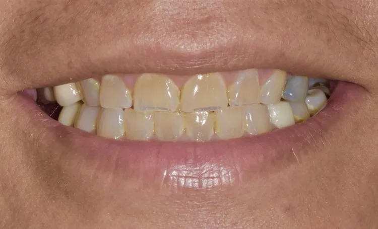 Smile gallery case 10 before