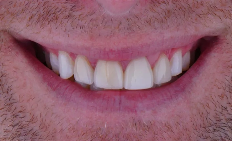 Smile gallery case 8 before