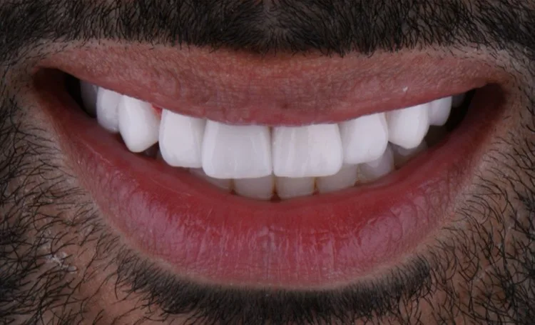 Smile gallery case 9 after
