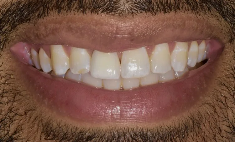 Smile gallery case 9 before